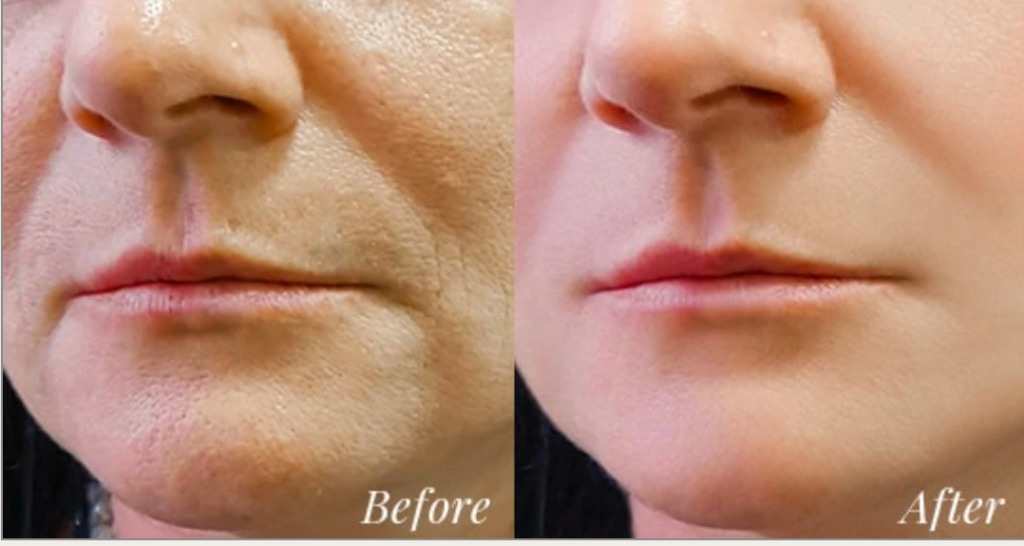 Before and after healthy moistured skin
